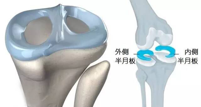膝关节很重要，从现在起就应该保护您的膝关节了